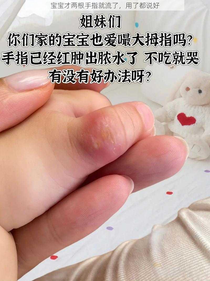 宝宝才两根手指就流了，用了都说好