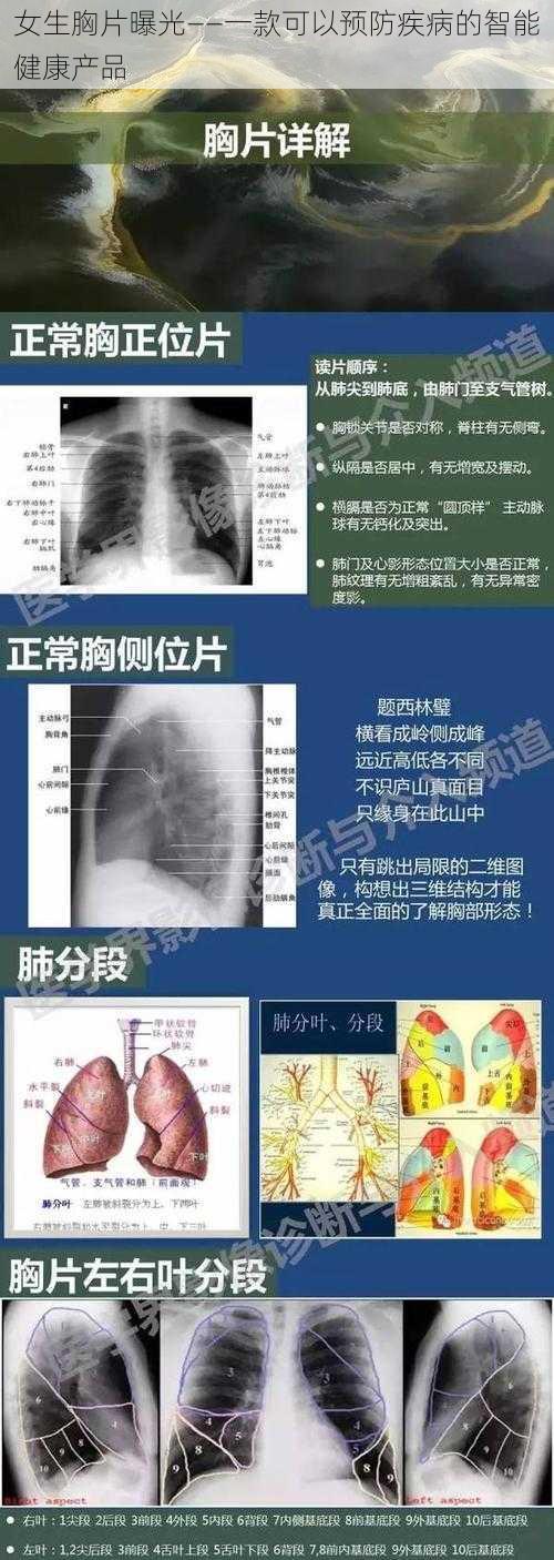 女生胸片曝光——一款可以预防疾病的智能健康产品