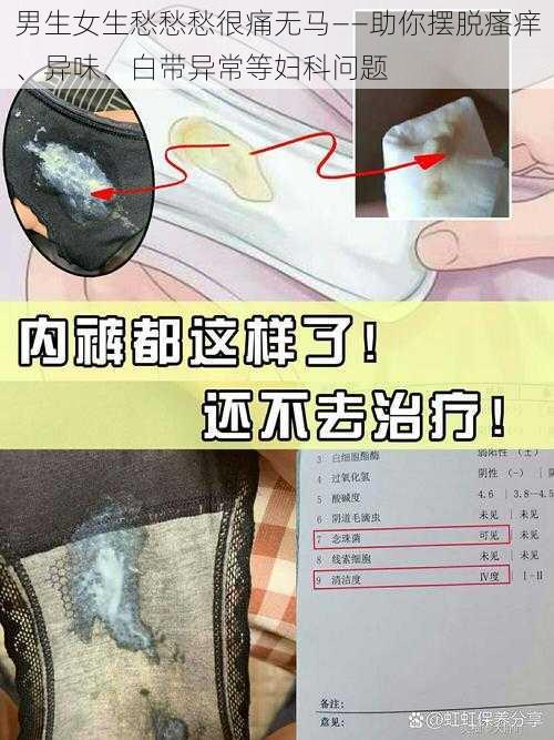 男生女生愁愁愁很痛无马——助你摆脱瘙痒、异味、白带异常等妇科问题