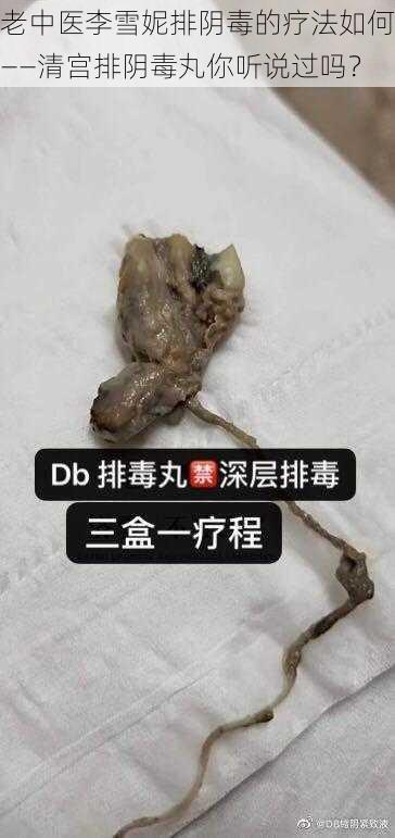 老中医李雪妮排阴毒的疗法如何——清宫排阴毒丸你听说过吗？